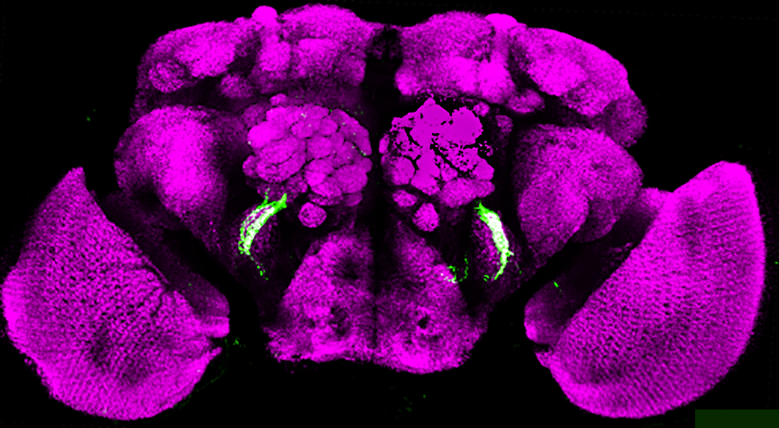 Microscopic image of a fruit fly brain Microscopic image of a fruit fly brain showing several neurons specified during development of the deutocerebral-tritocerebral boundary.